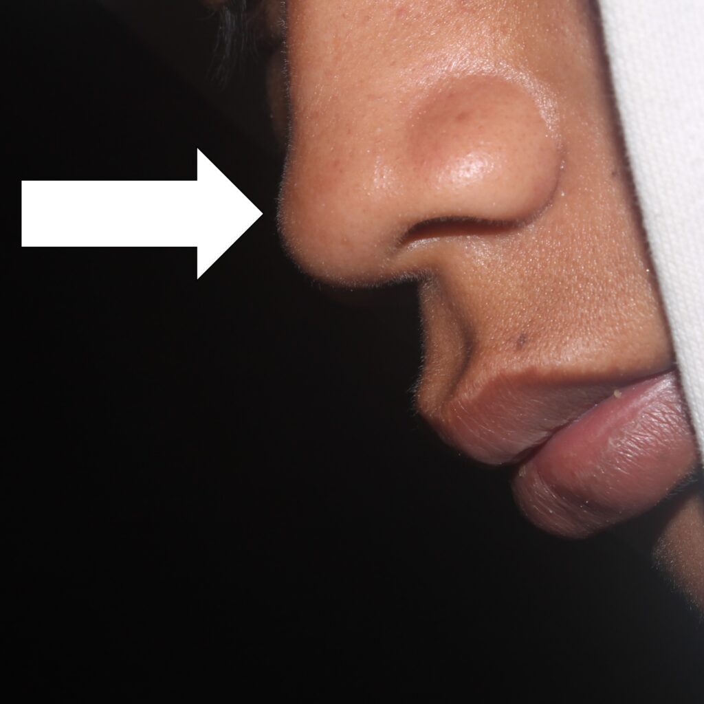 A close-up showing the profile of a nose and lips with an arrow pointing to the nose to illustrate which body vocabulary term to focus on.